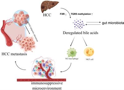 Deregulated bile acids may drive hepatocellular carcinoma metastasis by inducing an immunosuppressive microenvironment